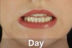 Close-up picture of a woman's mouth about to speak and the word written in the center at the bottom.